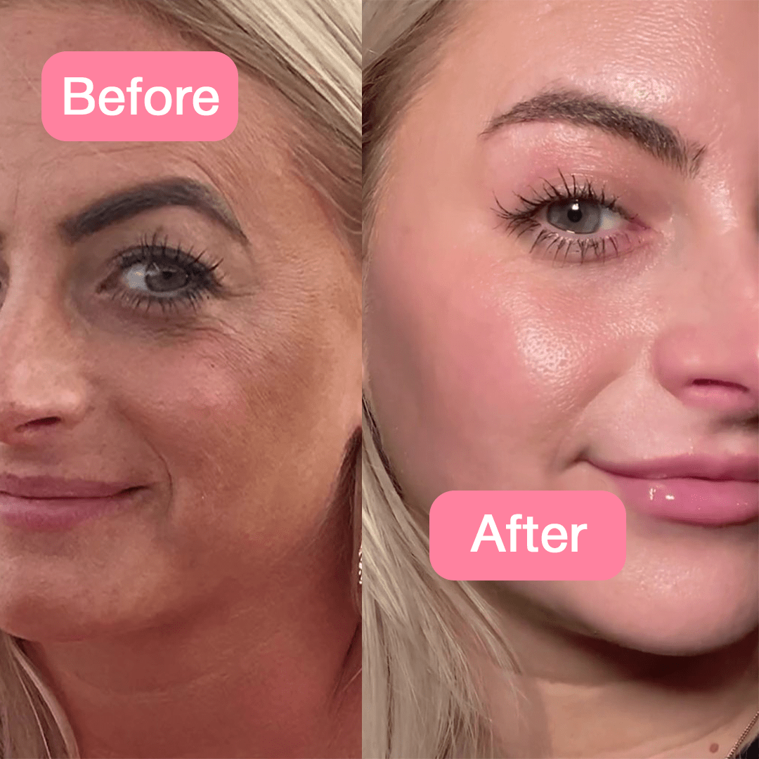 Kolajen+Niacinamide Jelly Krem