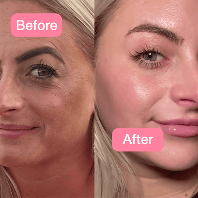 Kolajen+Niacinamide Jelly Krem